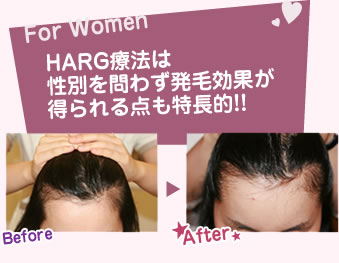 HARG療法は性別を問わず発毛効果が得られる点も個特徴的!!
