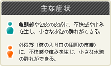 ヘルペス 画像 性器 性器ヘルペスの治療法！再発防止と治療薬